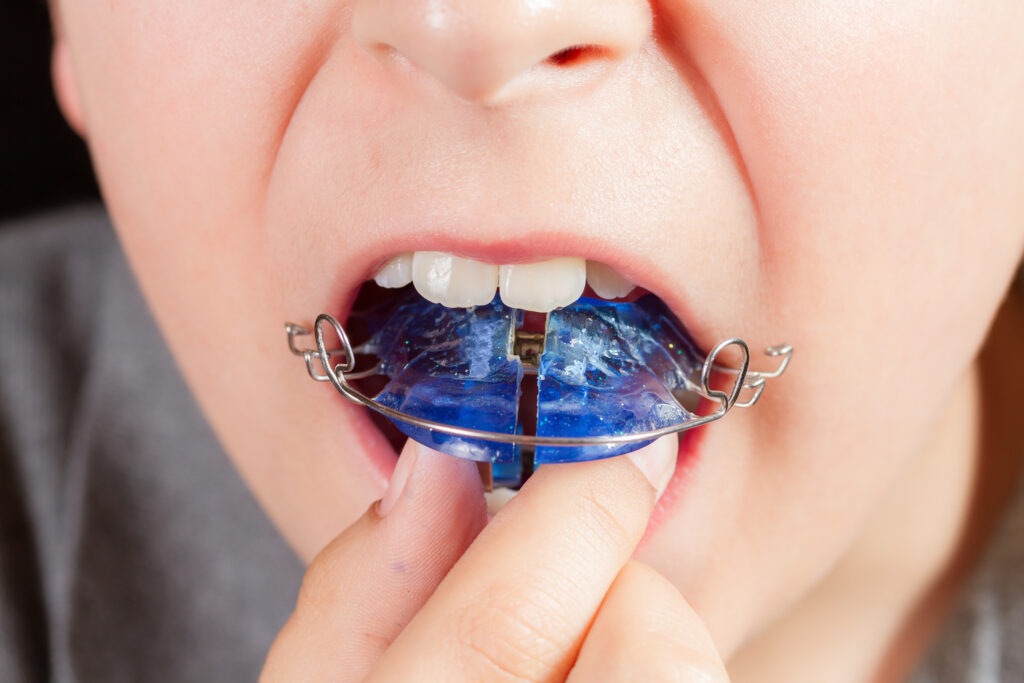 What Cosmetic Dentistry Can and Can’t Fix: A Professional Overview