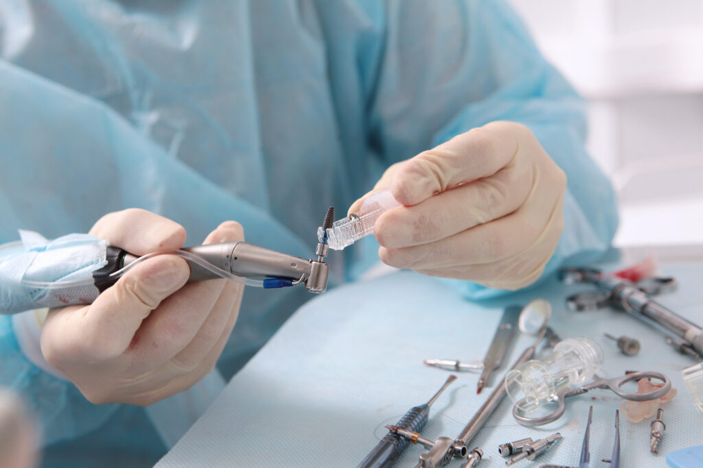 Dental Implants in Katy, TX: The Best Long-Term Solution for Missing Teeth?