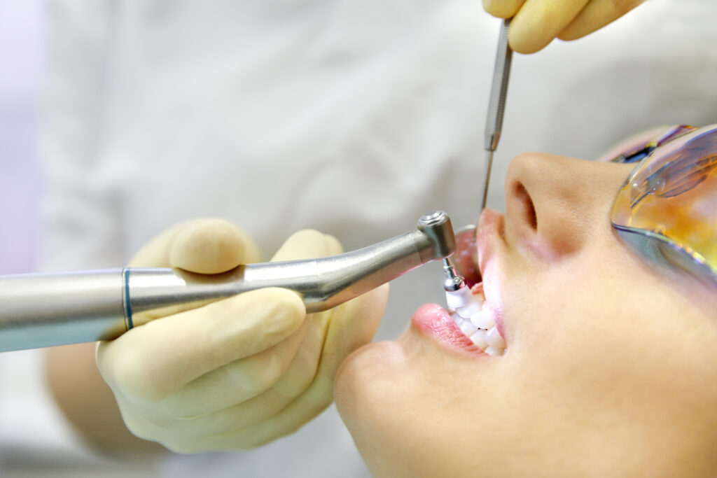 How Often Should You Really Get a Dental Cleaning?